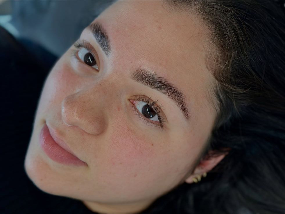 Browlift + restructuration