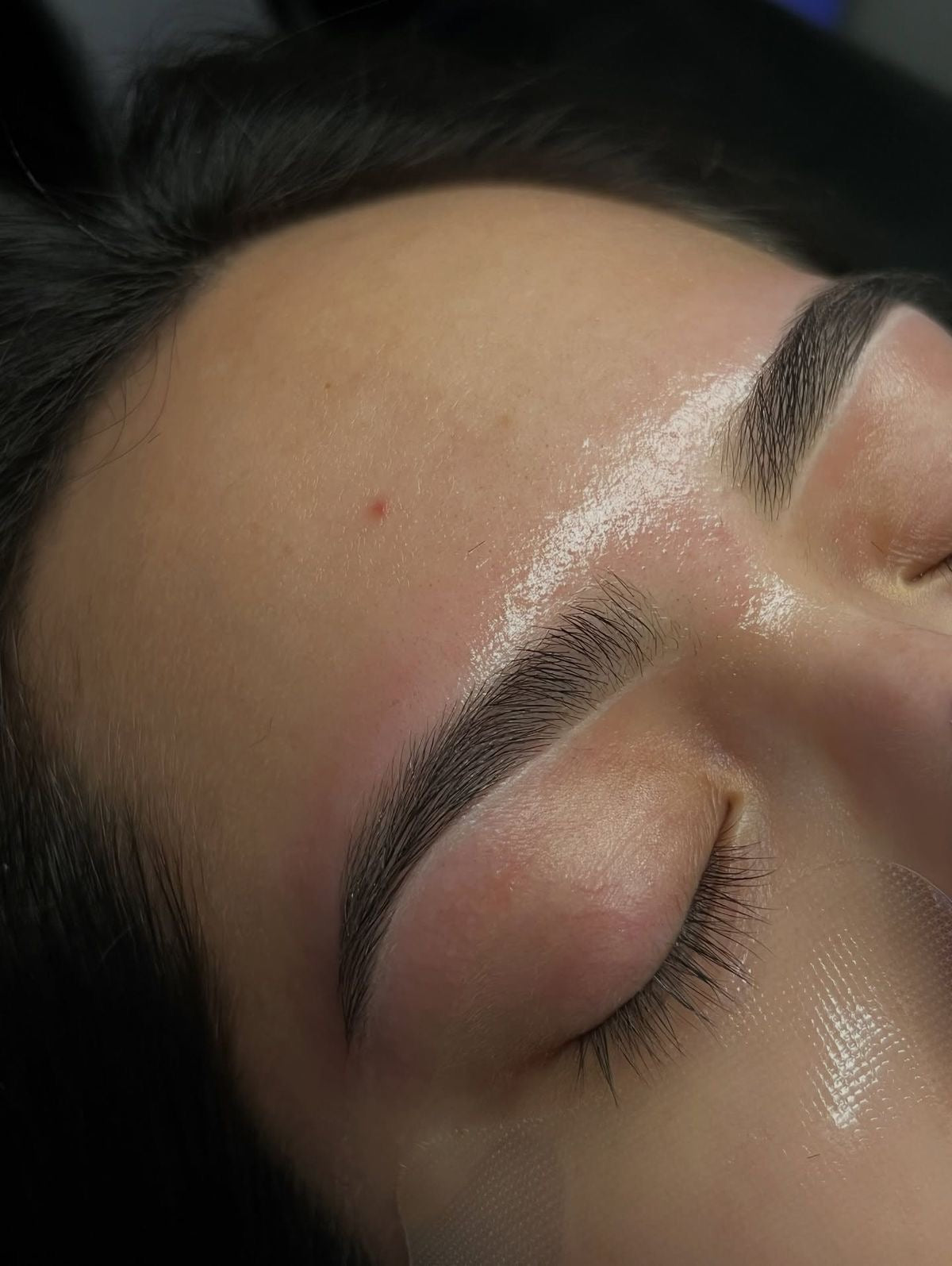 PACK COMPLET BROWLIFT